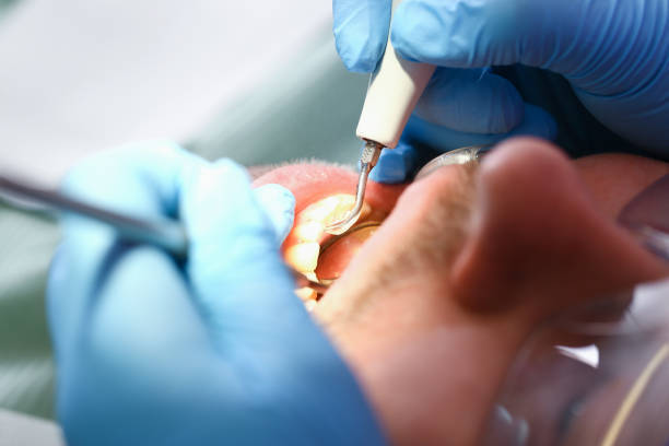 Best Emergency Dentist for Knocked-Out Tooth in Beckett, NJ